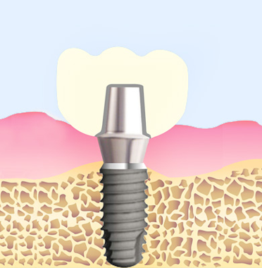 기성 지대주 구조