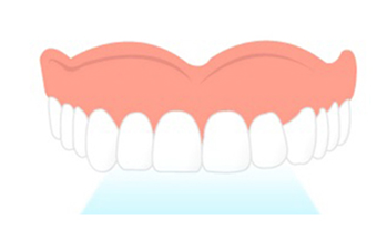 치아미백 광선조사